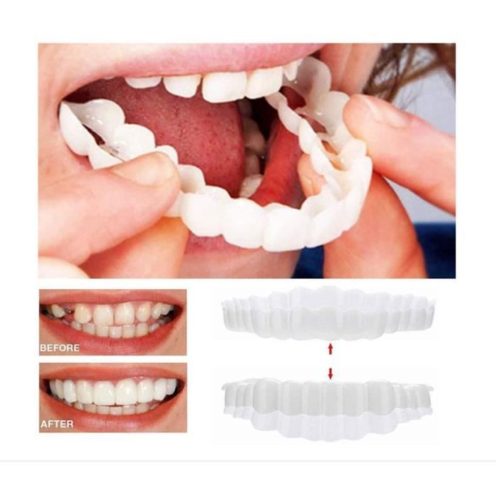 Dentier Sourire Fausse Dents Facette Dentaire Couvre Dents Artificielles 2  Haut Et 2 Bas Réutilisable Prothèses Dentaires Facettes - Cdiscount Au  quotidien