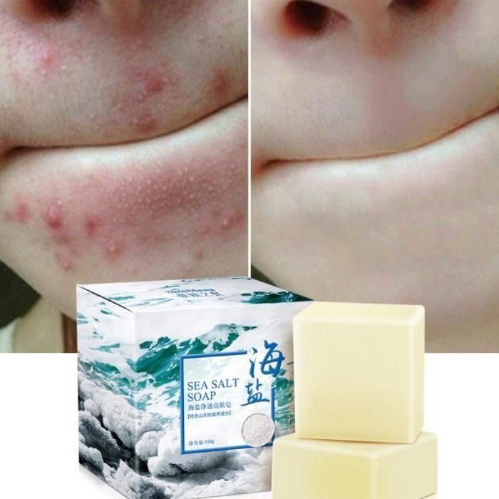 Savon au sel de mer naturel au lait de chèvre, ROMANTIC BEAR cicatrices de points noirs et d’acné savon anti-cellulite, visage pou