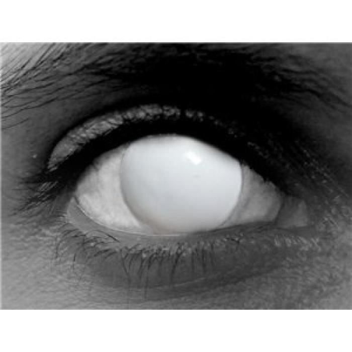 Lentilles totalement blanches