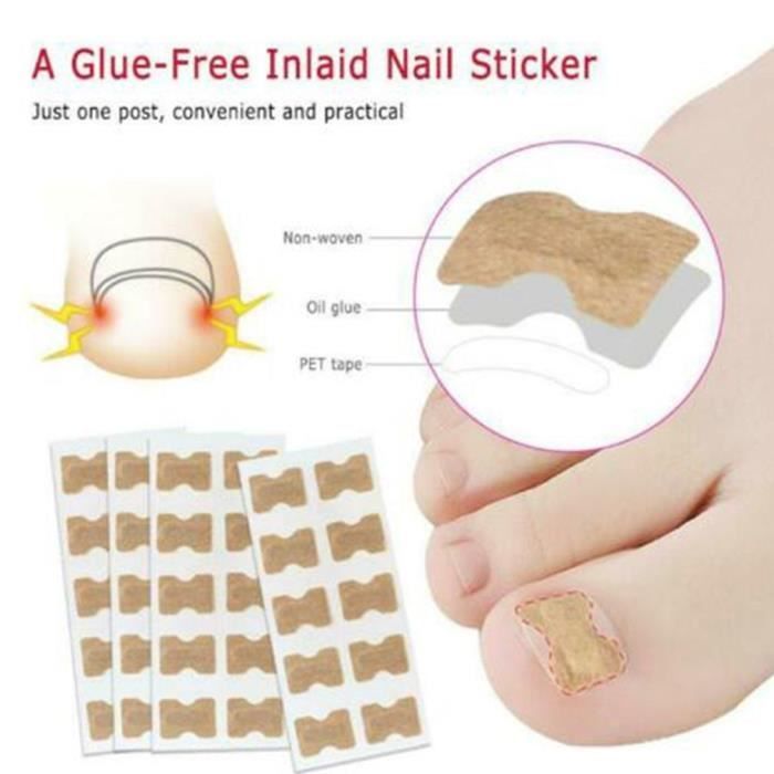 Lot de 50 Autocollants de Correction pour Ongles Incarnés en Coton Élastique Respirant Avec Ruban Adhésif Double Face