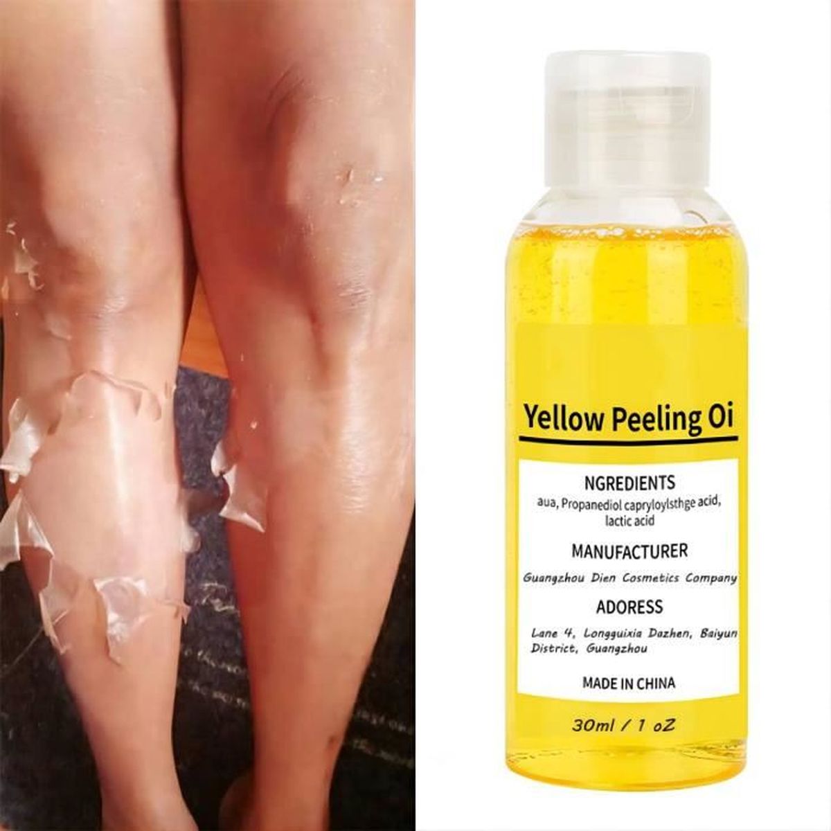 Yellow Peeling Oil for Dark Skin, Yellow Peeling Oil Extra Strength