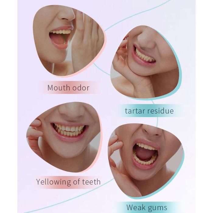 Dentifrice Blanchissant à La Niacinamide – Lot De 2 Tubes De 200g, Contre Les Taches Et La Mauvaise Haleine