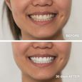 Blanchiment dentaire - Kit Meawhite 20 minutes, 3 étapes - Formule brevetée sans peroxyde - Technologie Lampe LED - Plastimea-1