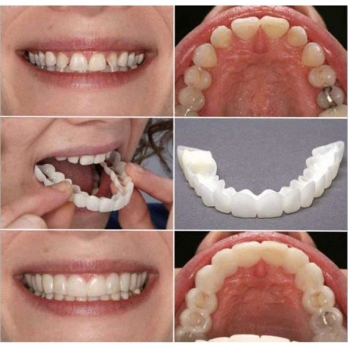 2 Set Silicone Dentier Haut et Bas Sourire Parfait pour Homme et Femme Amovible Naturel Fausse Dents Provisoire Facette Dentaire