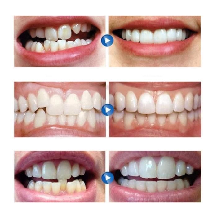 Porte-bavoir Silicone Coloré Avec Clip Dentaire Amovible - Stérilisable, Pour Soins Infirmiers Ou à Domicile