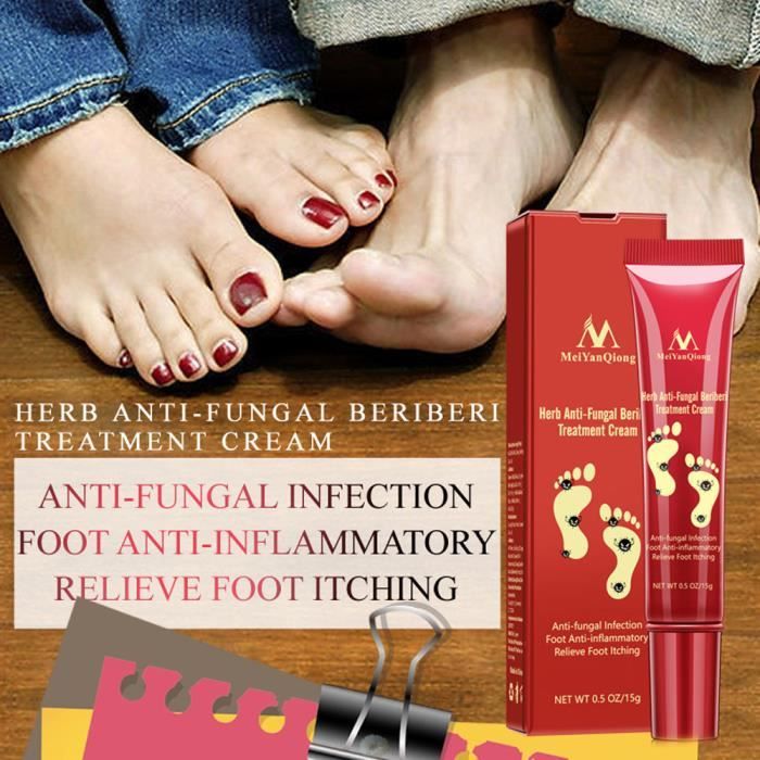 SOINDESPIEDS L'odeur des pieds élimine la pommade crème antifongique Tinea Pedis soins des pieds anti-démangeaisons