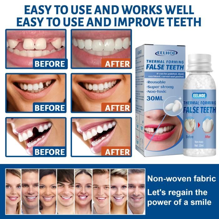 Dentier adhésif en résine plastique, réparation de l'espace entre les — free download