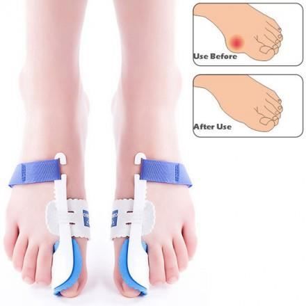 Appareil orthopédique pour hallux valgus ( Oign...