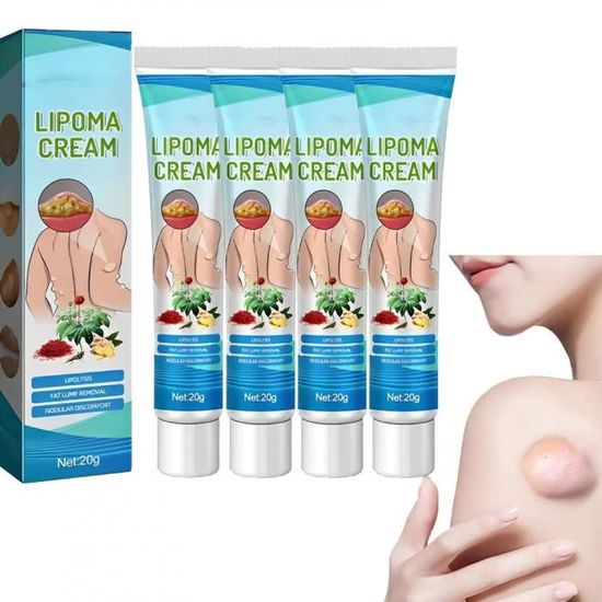 Crème Nettoyante Antibactérienne Lipomas - Présentée Comme Aide Pour L'élimination Des Amas Graisseux, Neuf
