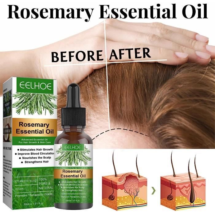 Pousse des cheveux : l'huile de Romarin est-elle efficace ?