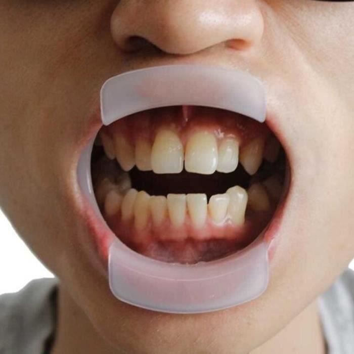 Anti 4x Ouvreur de bouche écarteur en forme de O Orthodontie dentaire  Ecarteur intra-oral Expanseur de lèvre écarteur de lèvre en - Cdiscount Au  quotidien