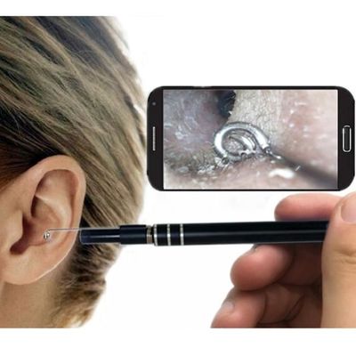 Médical Dans le nettoyage de l'oreille Endoscope Cuillère Mini Caméra  Sélecteur d'oreille Épi Épi Enlèvement de l'oreille visuelle Bouche Nez