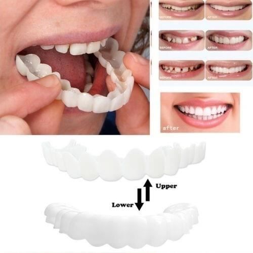 Snap On Instant Perfect Smile Comfort Fit Flex s'adapte aux placages supérieurs des dents inférieures