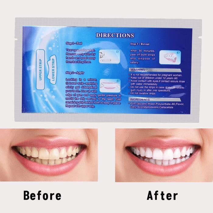 Bandes de blanchiment des dents dentaires 28 pcs, kit de soins dentaires efficaces pour blanchir les dents avec gel