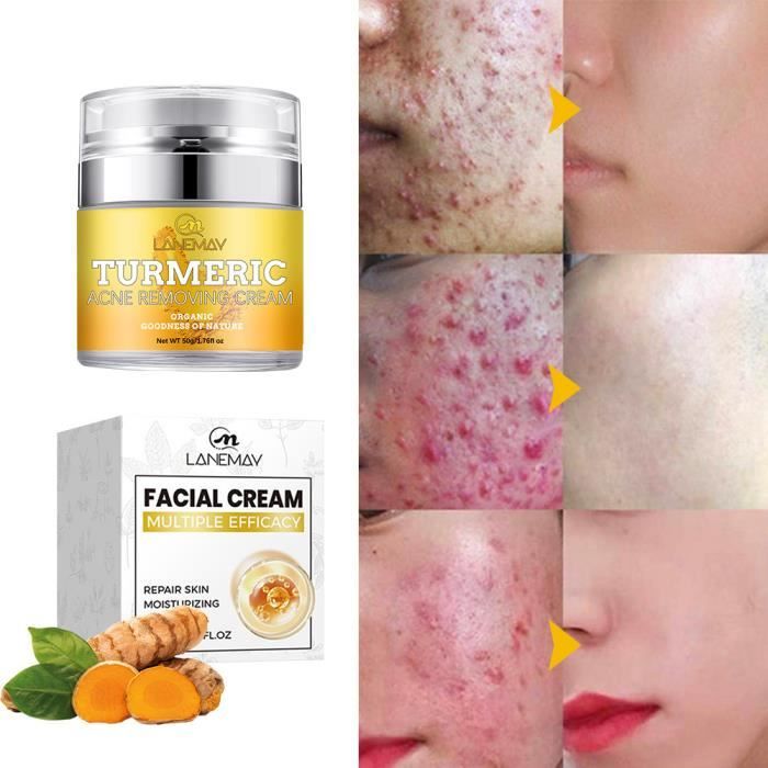 Hydrating Cream Crème Pour Le Visage Au Curcuma Pour Le Visage Et Le