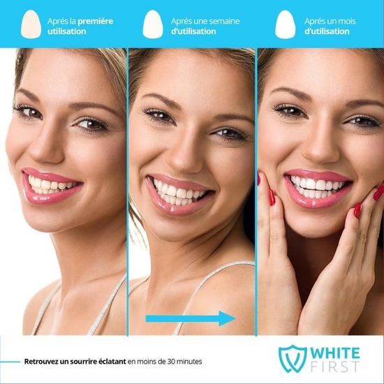 Spray Anti Tache Pour Blanchiment Dentaire Par White First Spray Nettoyant Pour Traitement Dentaire Blanchiment Des Dents Cdiscount Au Quotidien