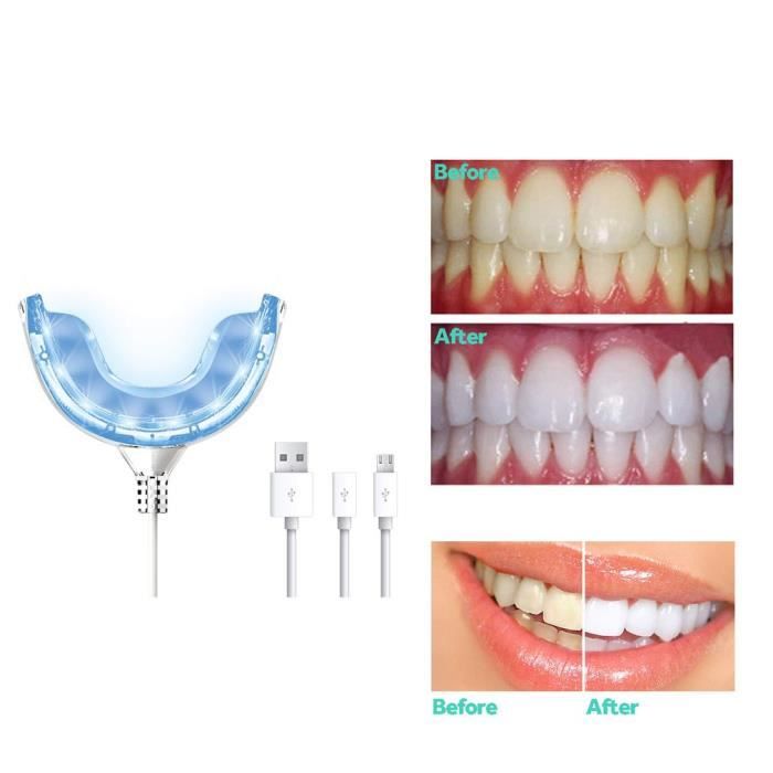 Kit Blanchiment Dentaire LED Lampe Dentaire, Gel Blanchiment Dentaire Professionnel Réutilisable Kit Dents Soins Dentaires à