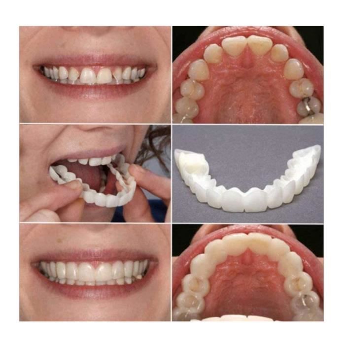 4 PCS/2 Set Silicone Dentier Haut et Bas Sourire Parfait pour Homme Femme Amovible Naturel Fausse Dents Provisoire Facette Dentaire