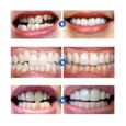 4 PCS/2 Set Silicone Dentier Haut et Bas Sourire Parfait pour Homme Femme Amovible Naturel Fausse Dents Provisoire Facette Dentaire-3