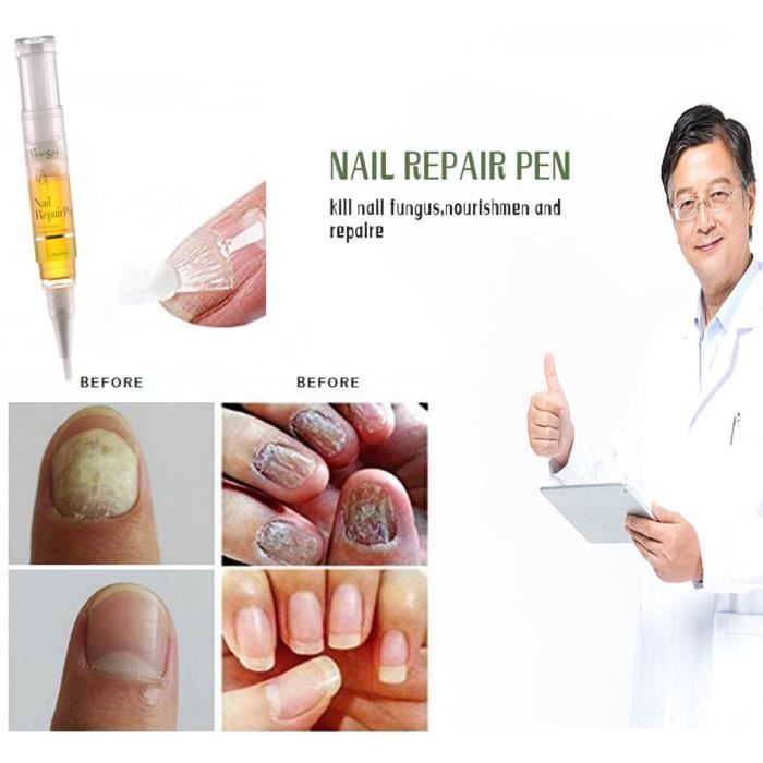 Nail Repair Solution Repair Bactéricide Soins infirmiers Maintenance Stylo de réparation des ongles LWL90402090