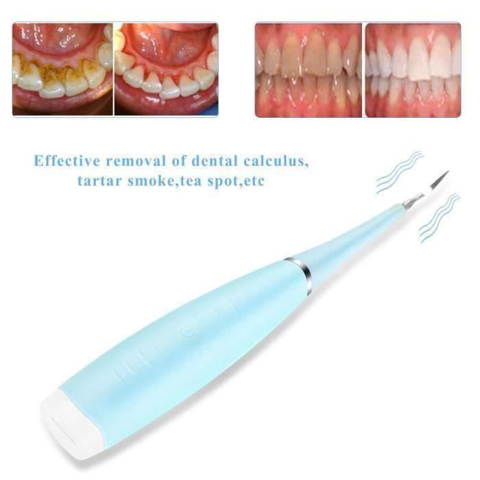 Detartreur Dentaire Ultrasons , Detartrage Dentaire Avec 5 Modes De Nettoyage, étanche IPX5 , Soin Blanchiment Et Dents Anti Tartre - Electroménager