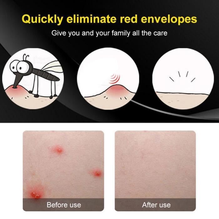 zerodis-stick-antipruritique-anti-piq-res-de-moustique-bouton-de-piq-re